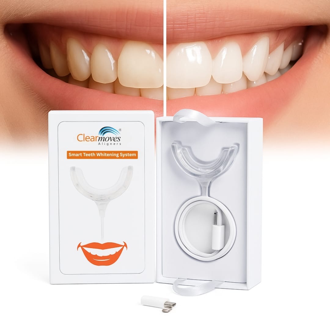 Bright Teeth Whitening Kit