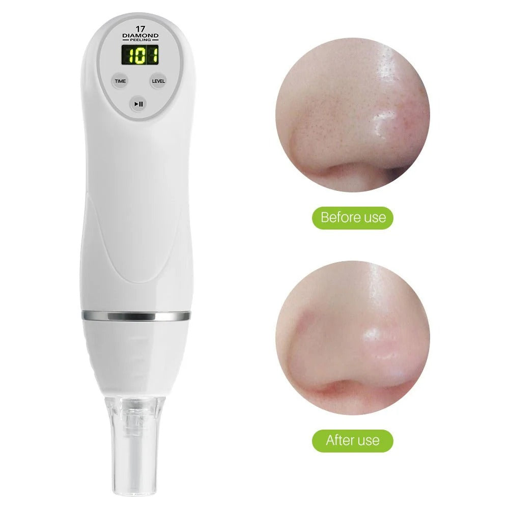 Pore Cleaning Device